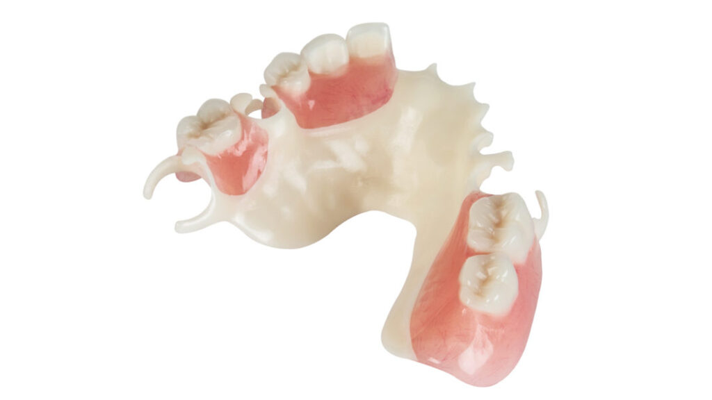 Zirlux Partial denture
