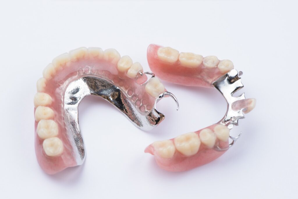 Removable metal partial denture on white background.